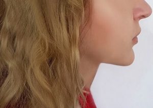 double chin treatments, the best aesthetics clinic in southampton