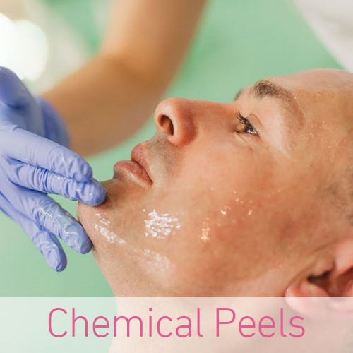 Chemical Peels at top clinics in Southampton, Portsmouth, Southsea, Totton, Hook, Petersfield, Chichester, Winchester Chemical Peels at top clinics in Southampton, Portsmouth, Southsea, Totton, Hook, Petersfield, Chichester, Winchester