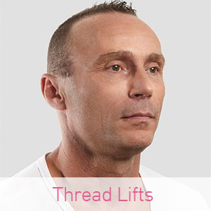 Thread Lifts Thread Lifts