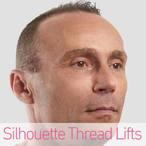 Silhouette Thread Lifts