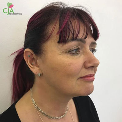 One Client’s Story: Before & After Treatments