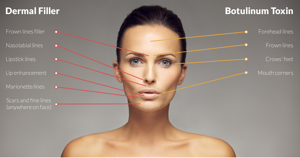 dermal fillers and botox at cja aesthetics clinics in southampton, Portsmouth, Southsea, Gosport, Fareham and Stubbington