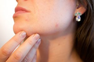 Skincare treatments, cja aesthetics salons, southampton, gosport, portsmouth, winchester, reading, hook