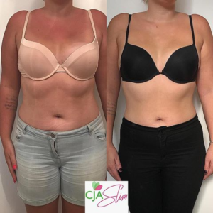 Body transformations through weight loss injections & healthy living at CJA Lifestyle UK