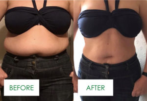 Saxenda Skinny Jab Weight Loss, CJA LIFESTYLE PLAN, HAMPSHIRE