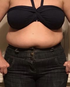 before weight loss cja lifestyle uk before weight loss at CJA Lifestyle Southampton