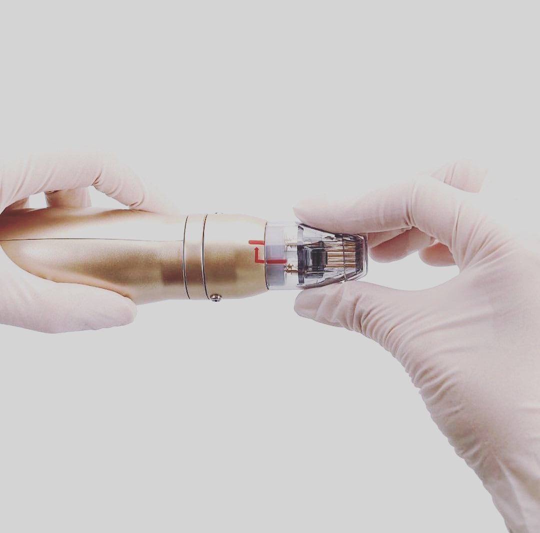 Sylfirm X RF Microneedling Southampton Clinic (5) Sylfirm X RF Microneedling Southampton Clinic (5)