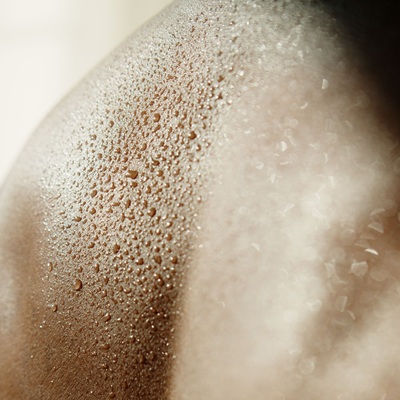 Excessive Sweating Excessive Sweating