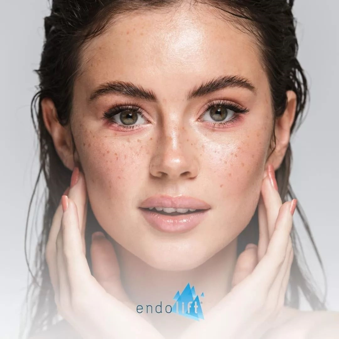 Endolift® Non-Surgical Skin Tightening Southampton Clinic Endolift Non Surgical Facelift Southampton Clinic