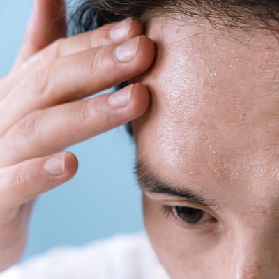 How to stop sweating Botox at CJA Aesthetic Clinics Hampshire How to stop sweating Botox at CJA Aesthetic Clinics Hampshire