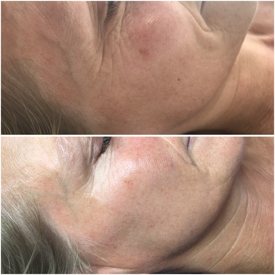 PIGMENTATION TREATMENTS NEAR ME PIGMENTATION TREATMENTS NEAR ME