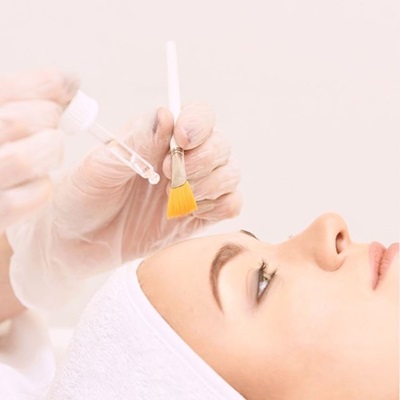 chemical peels at best skin clinic in SOUTHAMPTON chemical peels at best skin clinic in SOUTHAMPTON