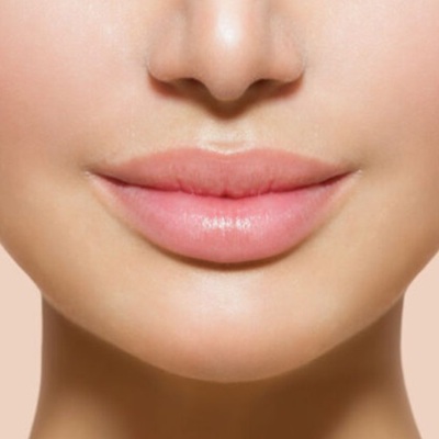 lip fillers at best aesthetics clinics in Hampshire