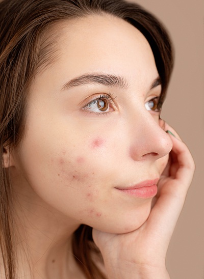 improve scars with treatments at cja aesthetics clinics hampshire improve scars with treatments at cja aesthetics clinics hampshire