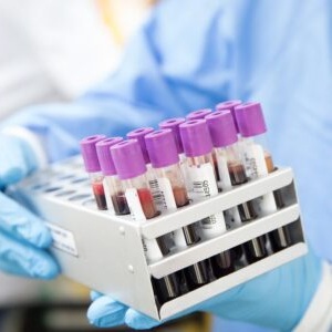BLOOD TESTING BLOOD TESTING